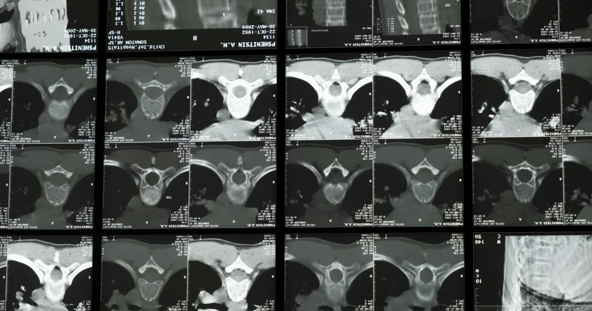 Downtown Windsor, CT, CT